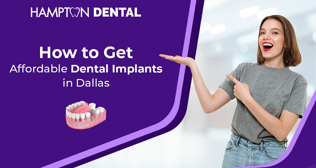 How To Get Affordable Dental Implants In Dallas