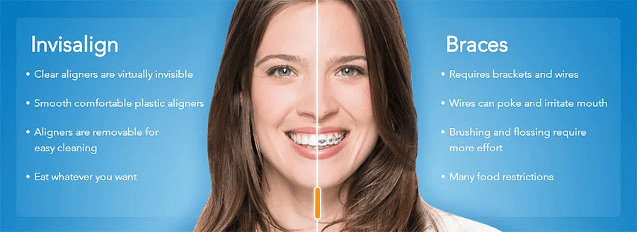 Is Invisalign Better Than Braces