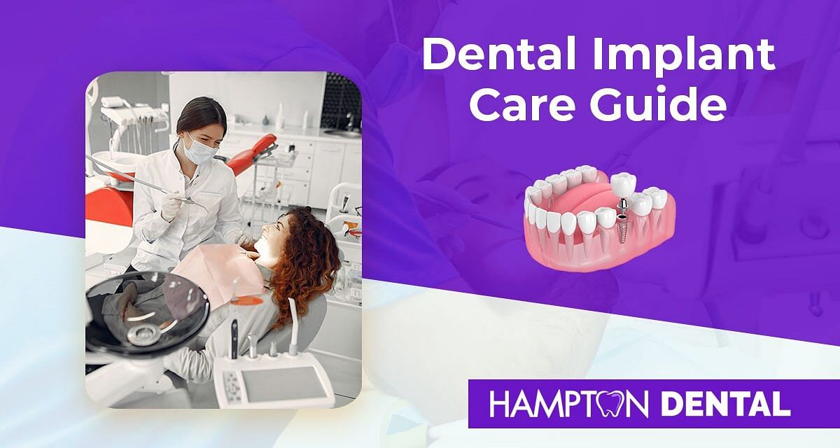 Dental Implant Care Guide