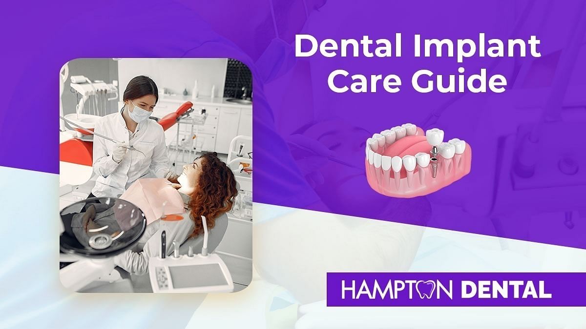 DENTAL IMPLANT CARE GUIDE