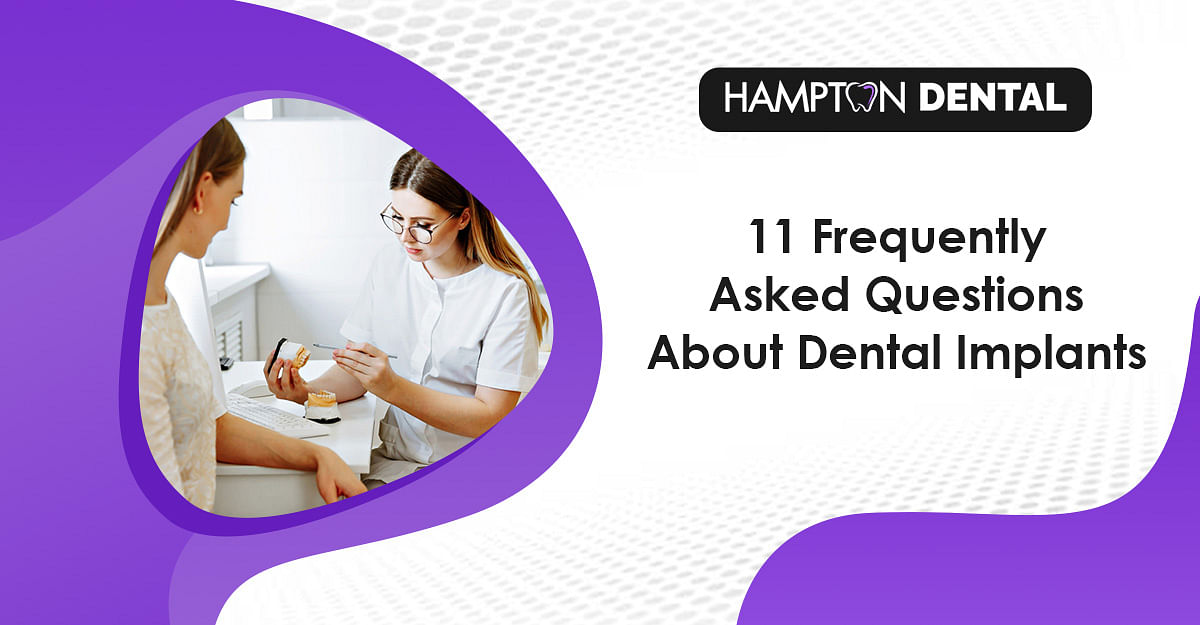 11 Frequently Asked Questions About Dental Implants