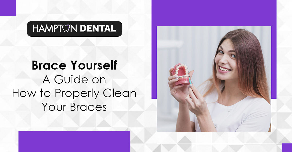 The Ultimate Guide to Achieving a Beautiful Smile with Traditional Braces