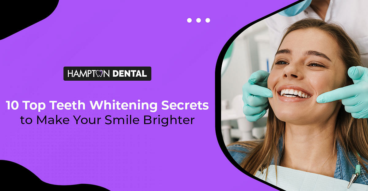 10 Top Teeth Whitening Secrets to Make Your Smile Brighter