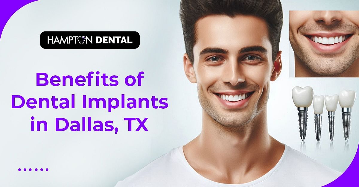 Benefits of Dental Implants in Dallas