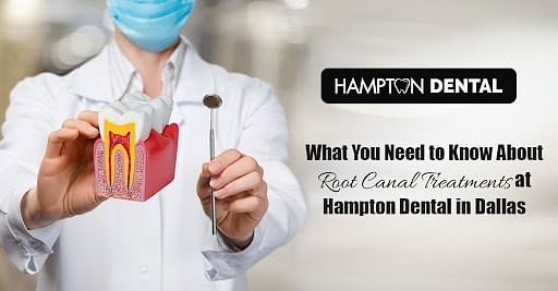 What You Need to Know About Root Canal Treatments at Hampton Dental in Dallas