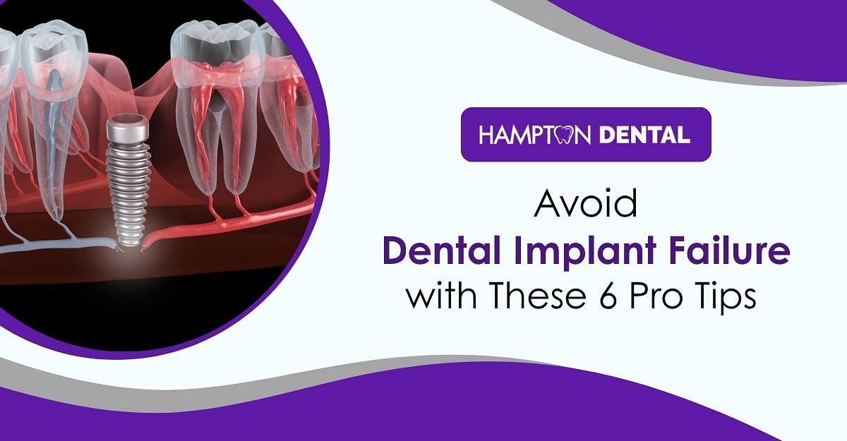 avoid-dental-implant-failure-tips Avoid Dental Implant Failure: 6 Expert Tips for Success