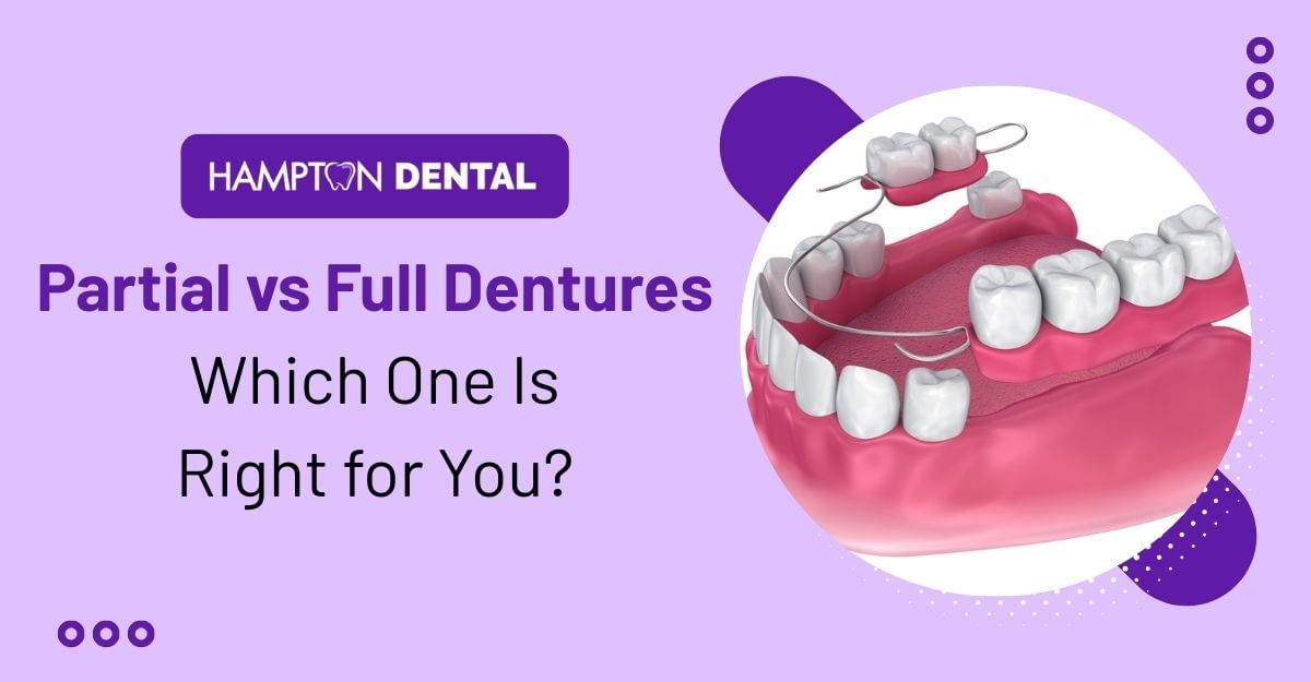Partial and full dentures options available at Hampton Dental Oak Cliff